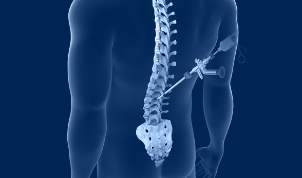 Endoscopic Spine Surgery