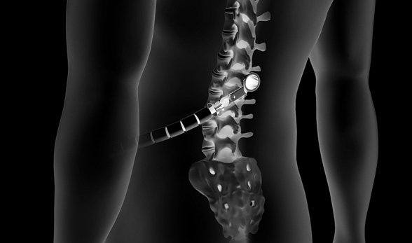 Minimally-invasive Spine Surgery 